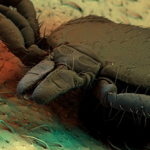 Aliens?! Ein Angriff aus dem All? Aber nein! Nur keine Panik! Hierbei handelt es sich um (von oben nach unten) einen Katzenfloh im Hundefell (REM-Aufnahme), die Larve eines Hundespulwurms unter dem Rasterelektronenmikroskop und eine Zecke auf einem Blatt (REM-Aufnahme). Also durchaus jedem Hundehalter bekannte Geschöpfe, die jedoch nicht zu unterschätzen sind. Fotos:© Convergo GmbH